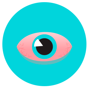 CONJUNTIVITIS